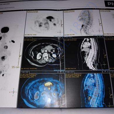 Medical Bill