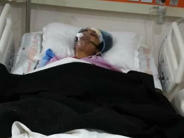 Help My Friend Reena Recover From Bilateral Fracture