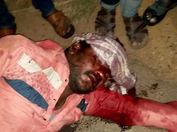 Help My Friend Gudala Shiva Who Met With A Road Traffic Accident Yesterday