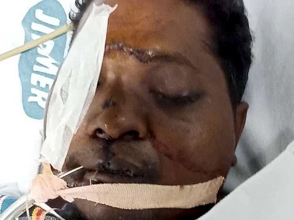 Help Solomon Arputharaj To Recover From The Dangerous Road Accident