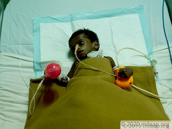 Help Baby Rabeeh Fight Extra Hepatic Biliary Atresia