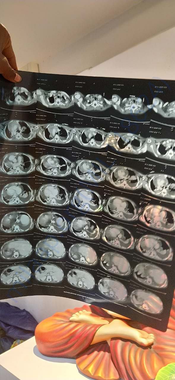 X-RAY