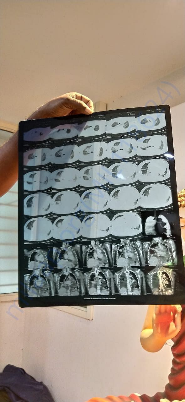 X-RAY
