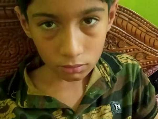 10 Years Old Jaspal Needs Your Help Fight Acute Lymphoblastic Leukemia (All).