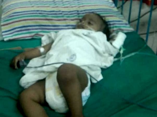 Help 1 Year Old Gunadeep Survive