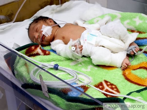 Help Ekta's Preterm Baby Recover