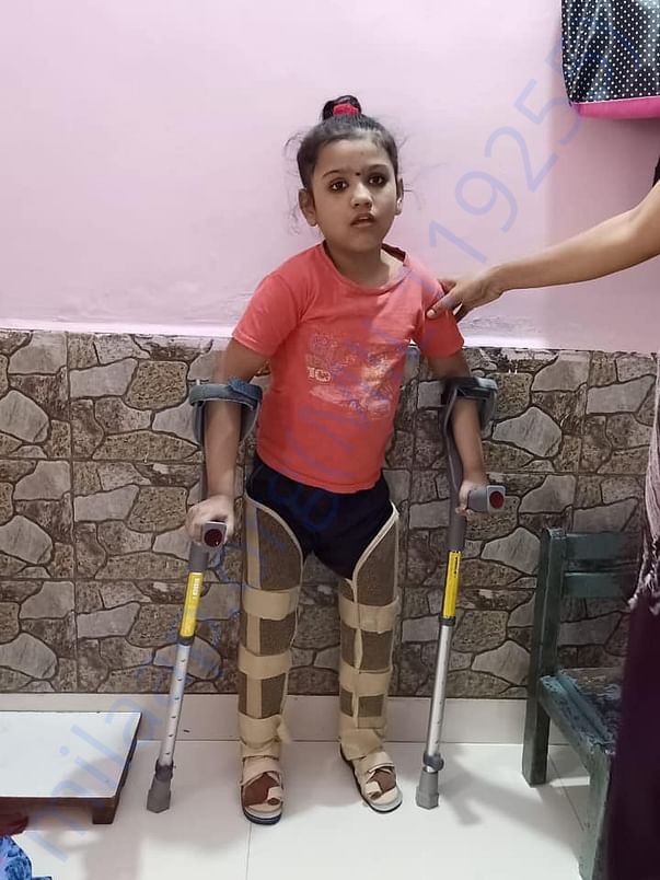 After surgery - Gunjan can stand with walker