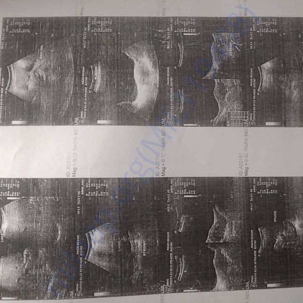 Medical Report