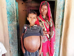 12 Years Old Pawan Kumar Yadav Needs Your Help Fight Massive Splenomegaly