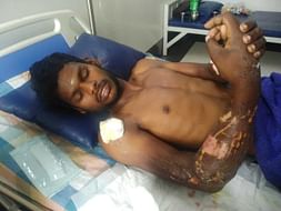 Support Hariharan Recover From Hand Injury