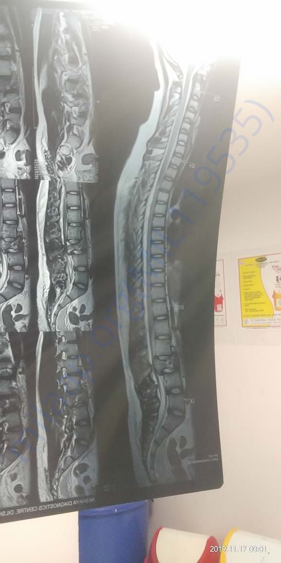 X-RAY