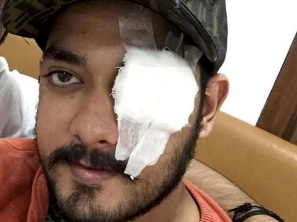 Help Krishna For Eye Operation