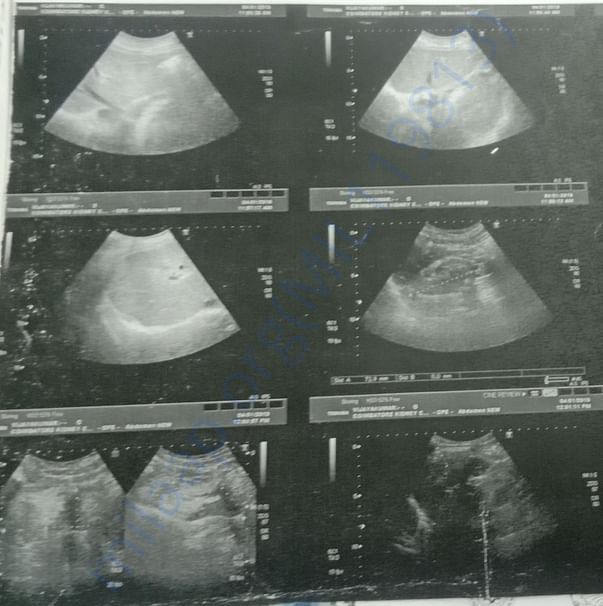 Medical Report