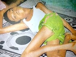 Help My Son Shivaram Recover From Wilson's Disease