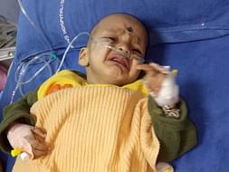 10 Months Old Aditya Needs Your Help Fight Anomalous Left Coronary Artery From The Pulmonary Artery