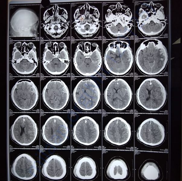 Medical Report