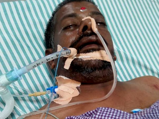 Support Srinivasareaddy Recover From Organs Failure And From Paralysis