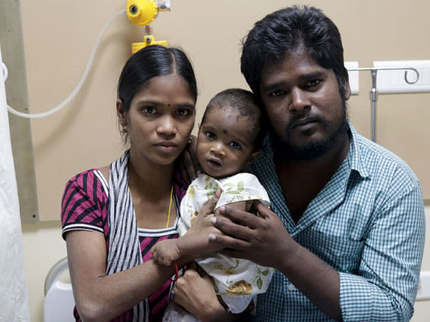 8 Months Baby Vignesh Suffering From Congenital Heart Disease