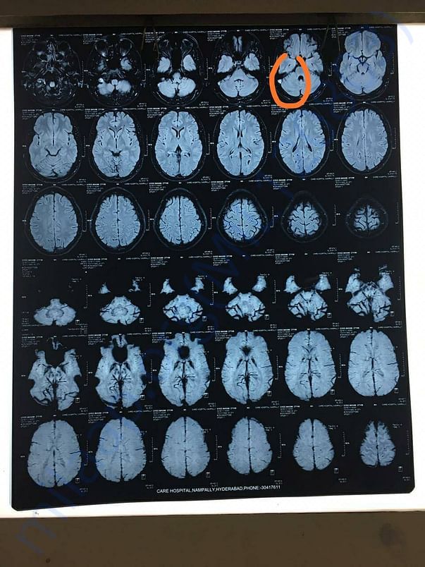 MRI Report - 2