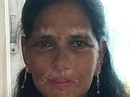Please Help Anupamma Fight Multiple Organ Dysfunction