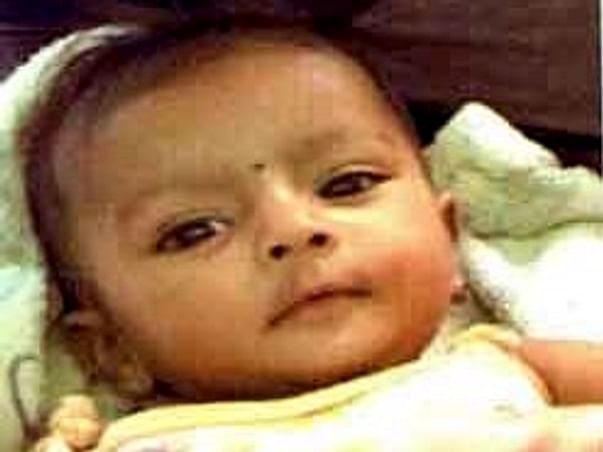 Help 9 Months-Old Baby Kavya To Survive Congenital Heart Defect