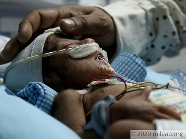 Help Varalaxmi's Twin Babies Recover