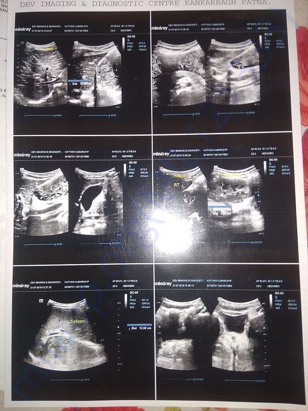 CT scan