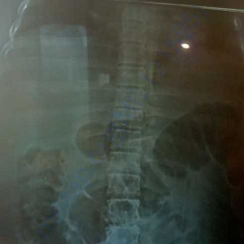 Medical Report