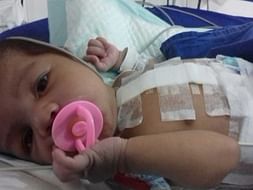 Support Arqam Feroz Recover From Transposition Of Greater Arteries