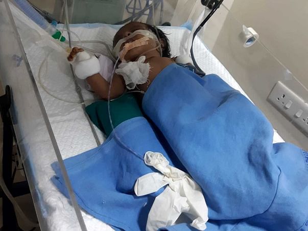 2 Months Old Baby Of Amer Need Your Help Fight Kidney & Liver Disorder