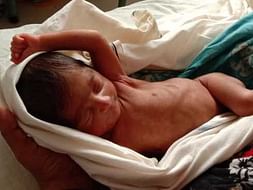 Help The Prematurely Born Twins, Fatherless Before Birth.