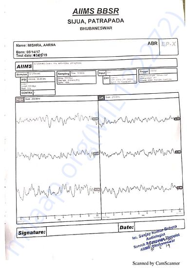 ASSR rEPORT
