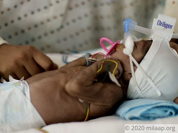 Help Santhoshi's Baby Fight Respiratory Distress And Sepsis