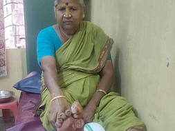 My Mother Is Struggling With Foot Infection, Help Her