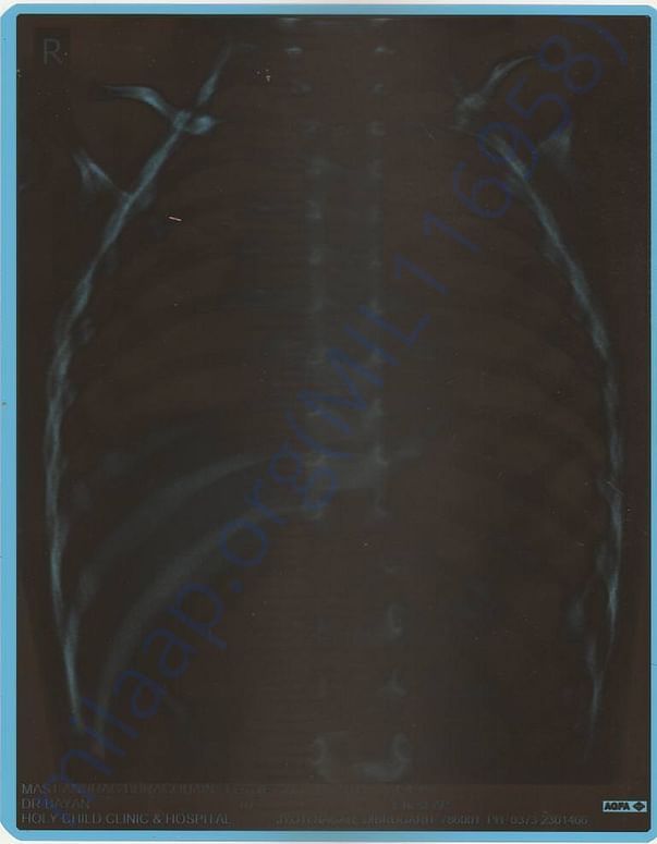 X-RAY REPORT 7