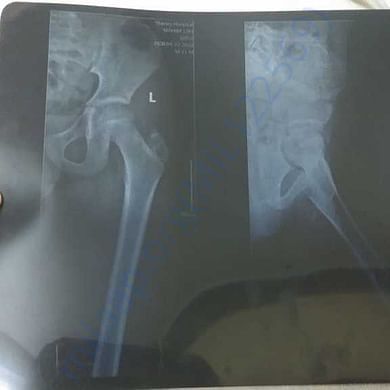 Medical Report