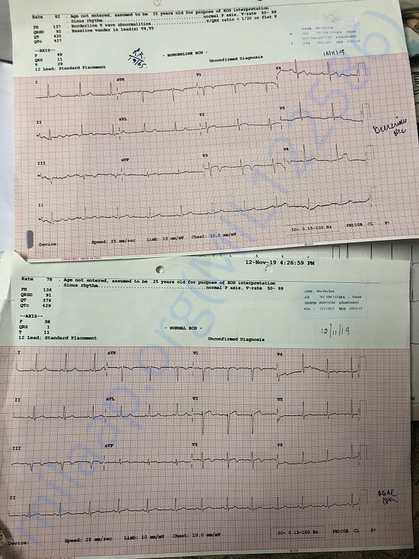 Ecg report