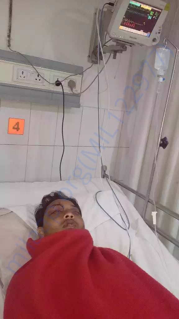 Accident 3