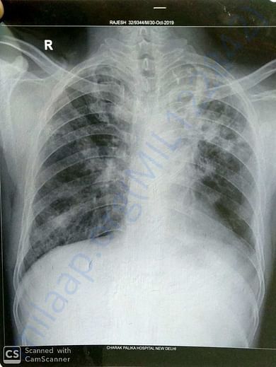 x-ray and reports