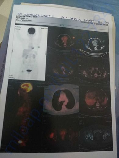 document3