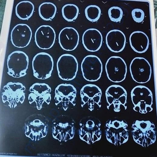 Medical Report
