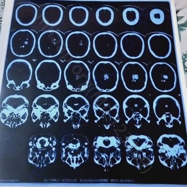 Medical Report