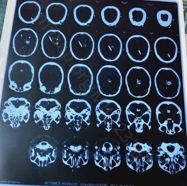 Medical Report