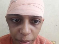 32 Years Old Jumana Needs Your Help Fight Brain Haemorrhage