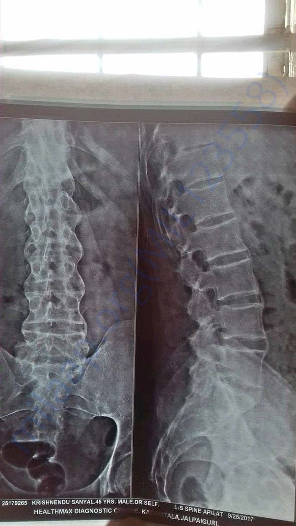 X-rays