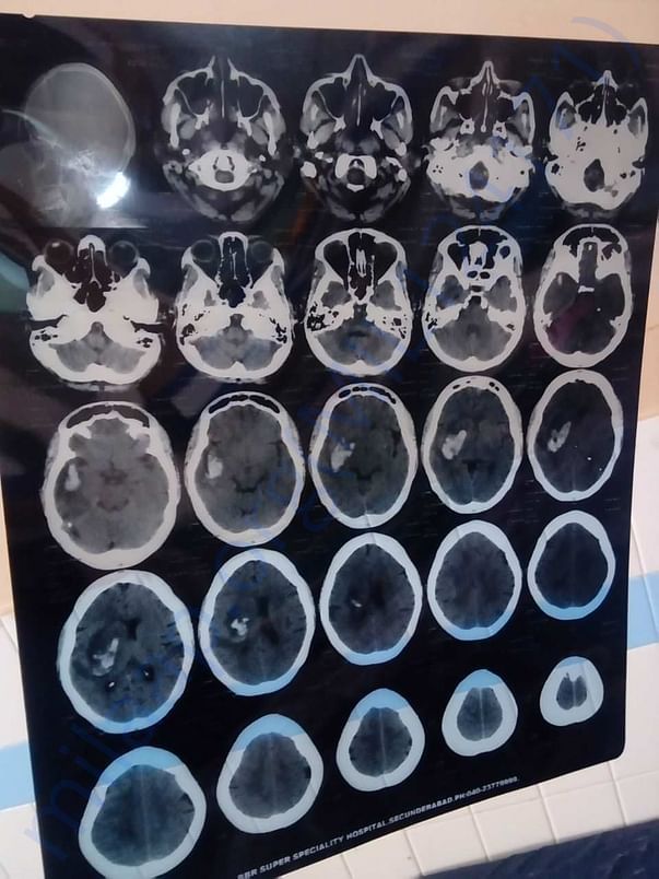 medical report