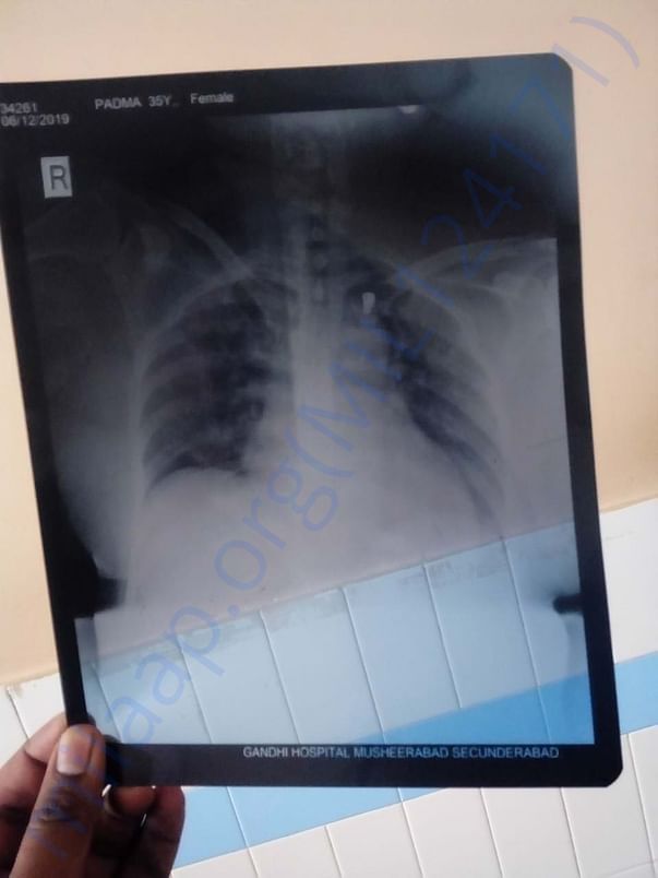 medical report
