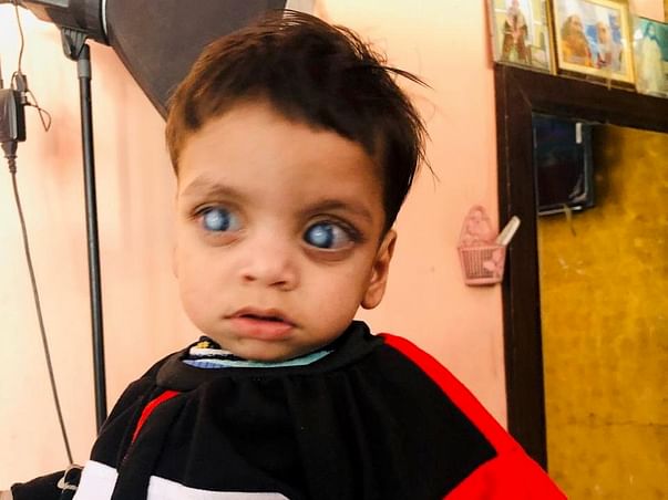 Help Ibrahim Fight Absolute Glaucoma