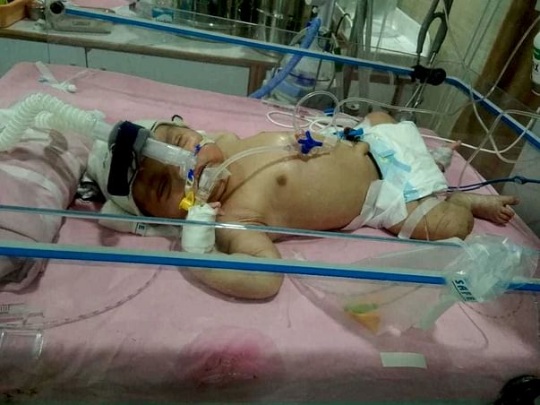 9 days old baby requires your help to survive.