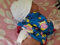 Newborn Baby is fighting for Spinal Cord Surgery to live